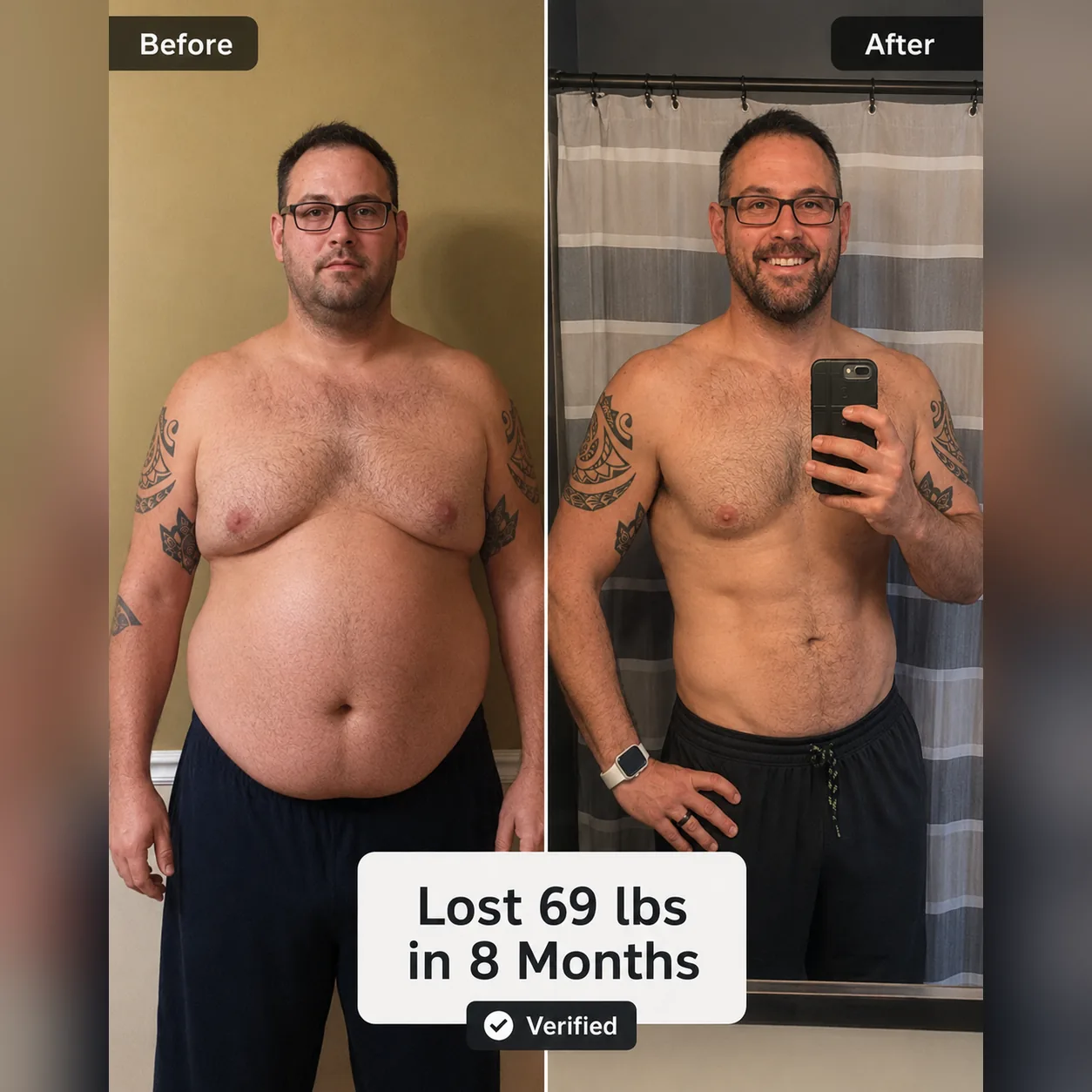 Patient lost 69 lbs in 8 months