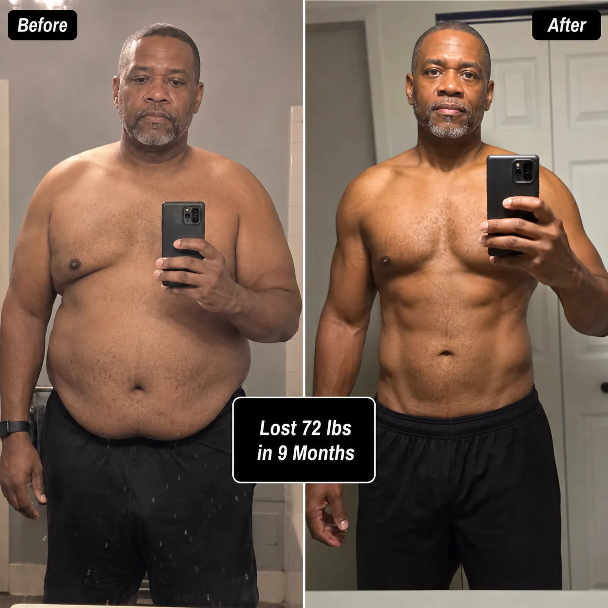 Patient lost 72 lbs in 9 months